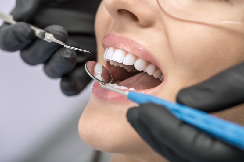 How Can I Protect My Dental Implants During Sports?